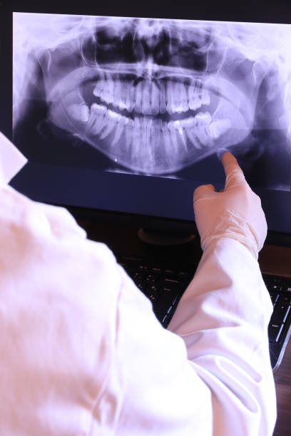 Best Emergency Wisdom Teeth Removal in Bishop, CA