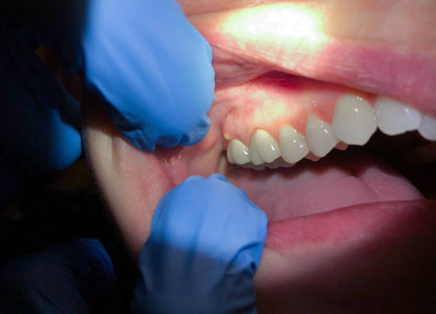 Best Emergency TMJ Treatment in Bishop, CA